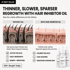 Professional Stop Hair Growth Inhibitor Serum Oil Painless Moisturizing Whitening Removal Non-irritating Skin Care Body Beauty